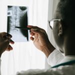 Herniated disc causing back pain after a texas car wreck